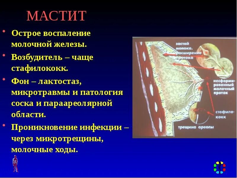 Паренхиматозный мастит. Воспаление молочной железы. Боль в области соска