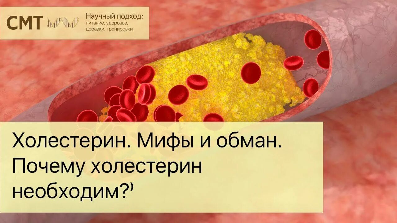 Холестерин. Мифы о холестерине. Мифы и факты о холестерине. Польза и вред холестерина.