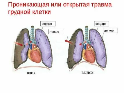 Чтоб открылись легкие