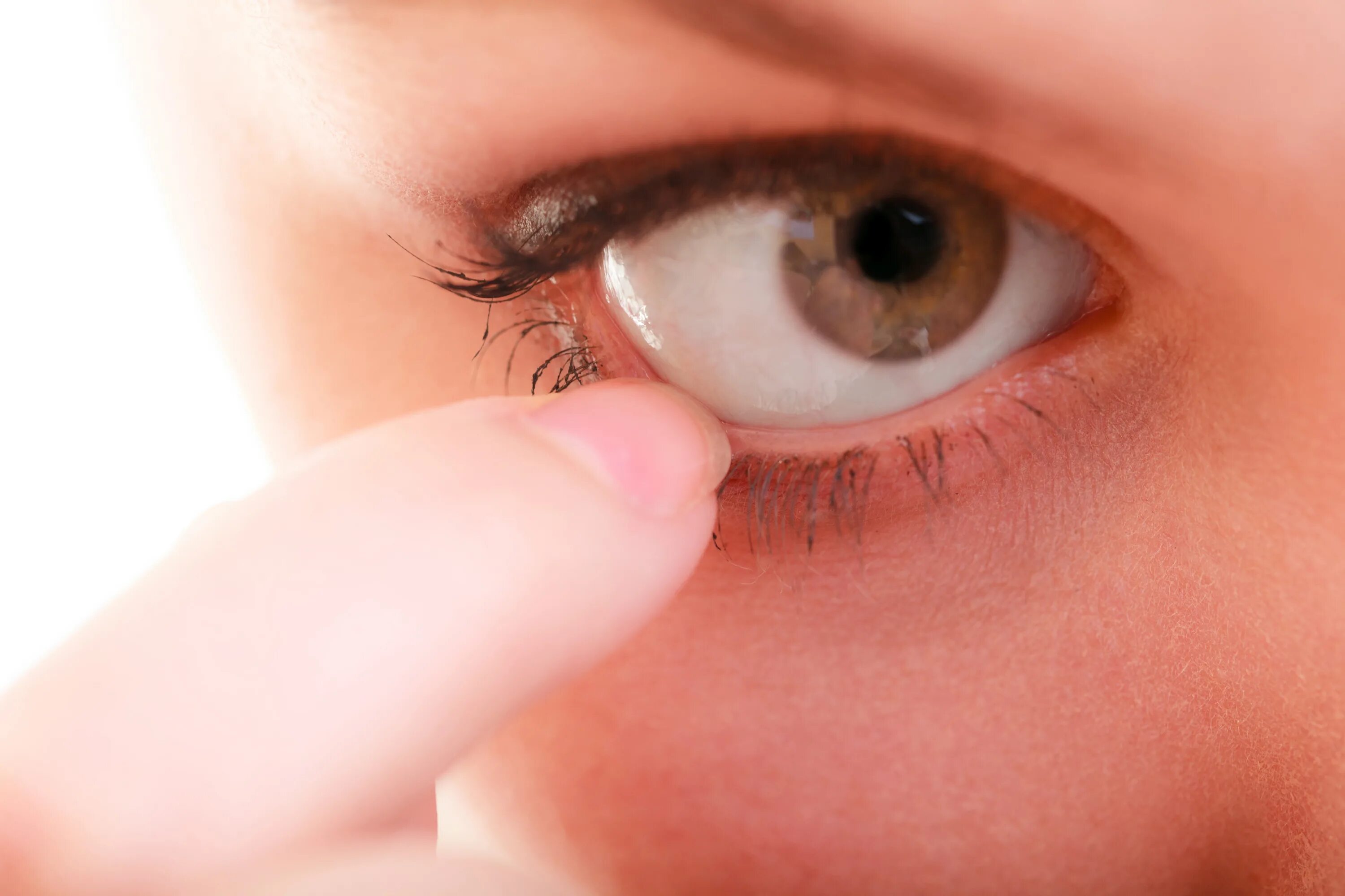 Образование на слизистой глаза. Почему болит глаз причины