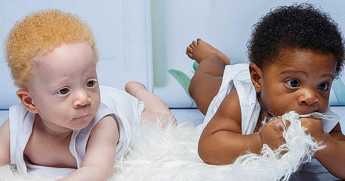 Черная рожден. Младенец негр. Дети в белом. Родился темнокожий ребенок. У младенца тёмный цвет кожи.