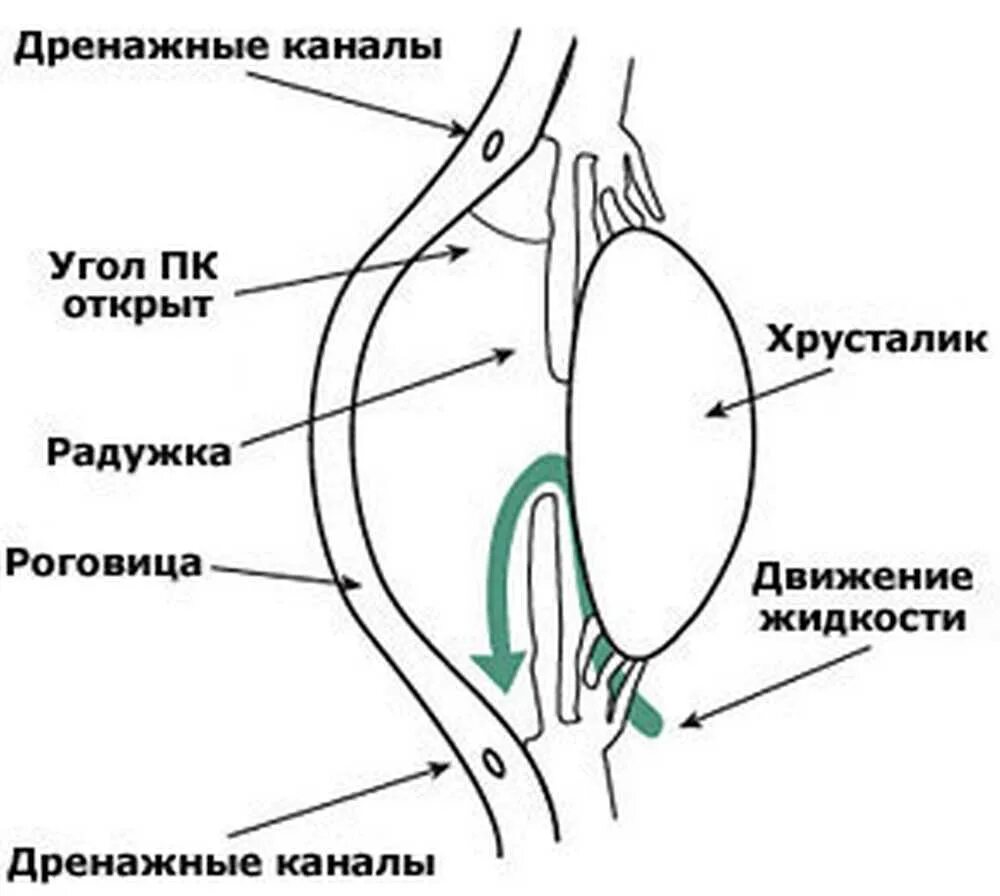 Глаукома латынь. Закрытоугольная глаукома глаза. Факоморфическая глаукома. Вторичная факотопическая глаукома. Глаукома схема.