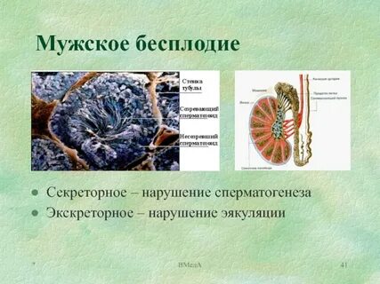 Как называются бесплодные мужчины