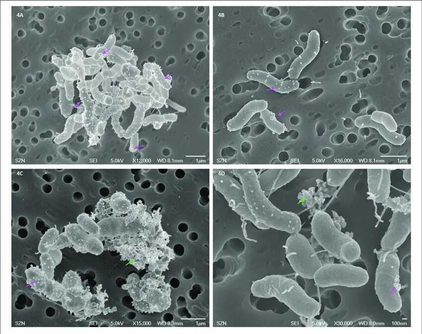 Организм трутовик окаймленный холерный вибрион. Бактерия Vibrio anguillarum. Вибриоз рыб возбудитель. Т мелкий вибрион Vampirovibrio chlorellavorus.