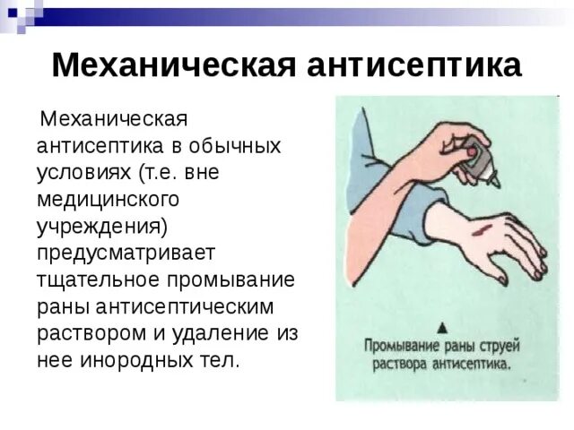 Промывание гнойных ран. Механическая антисептика. Методы механической антисептики. Механич антисептика. Механический метод антисептики.