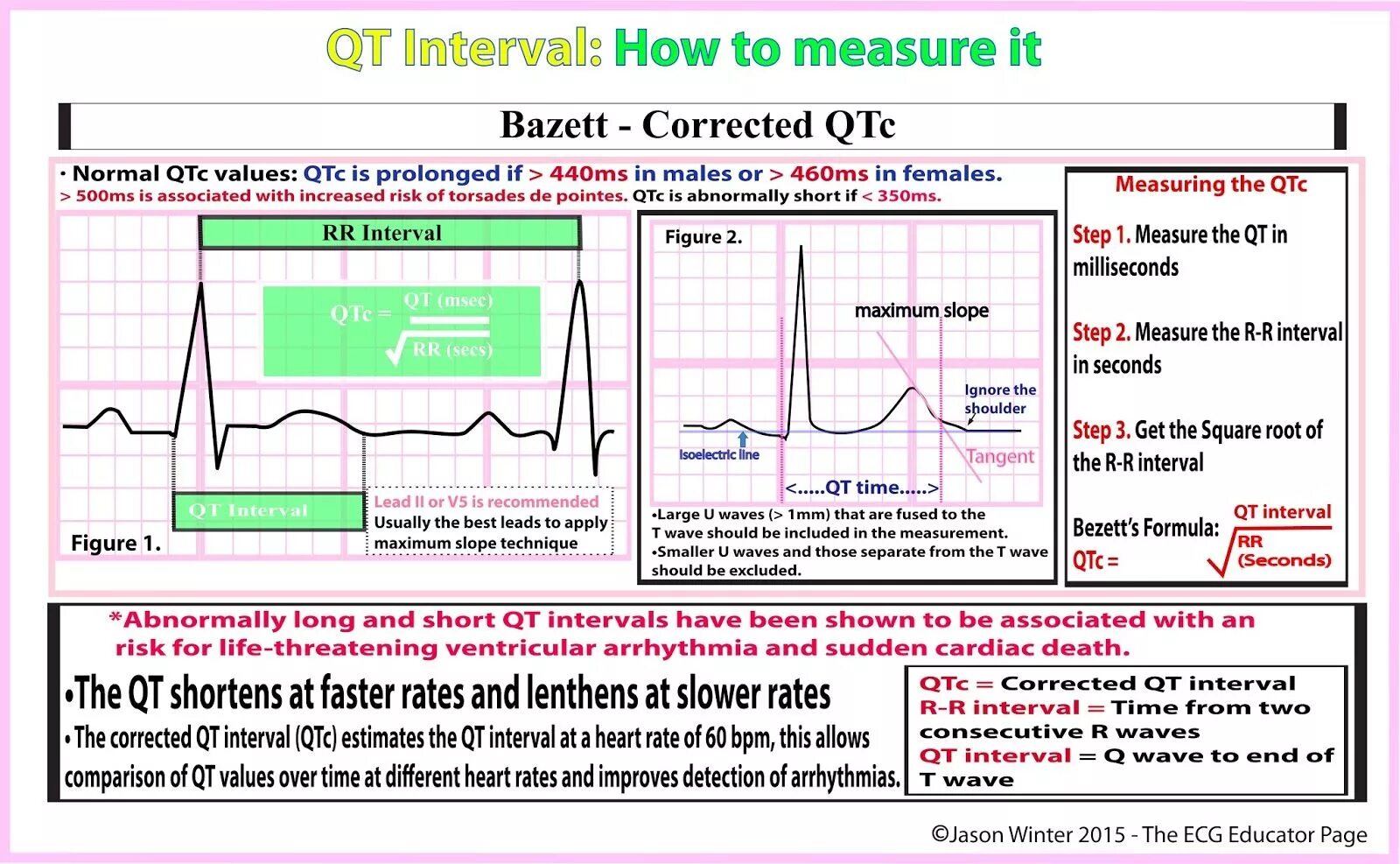 Re load interval 500 re upload interval. Интервал qt на ЭКГ. Корригированный интервал qt на ЭКГ. Корригированный интервал qt норма. Qt/QTC норма.