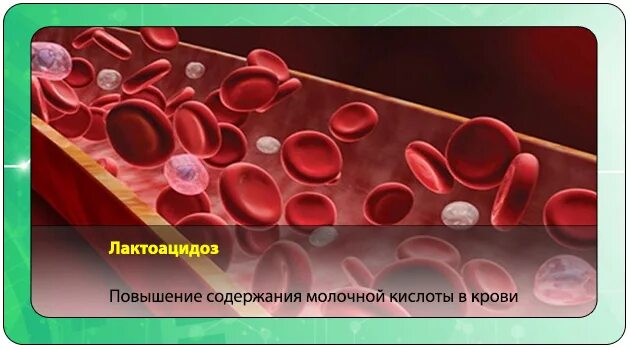 Повышенная кислота в крови симптомы. Лактоацидоз. Молочная кислота в крови. Лактатный ацидоз. Симптомы лактоацидоза.