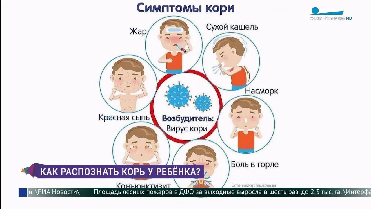 Осложнения после прививки от кори