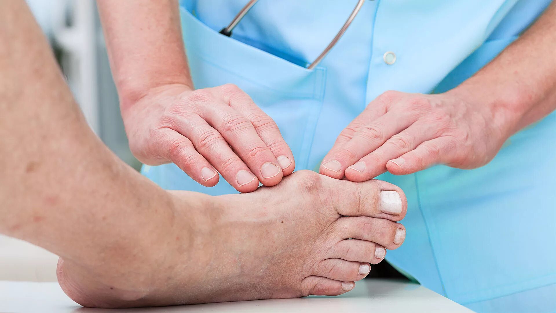 Борьба на пальцах ног. Пациент с диабетической стопой. Врач и пациент. Ревматоидный артрит реабилитация.