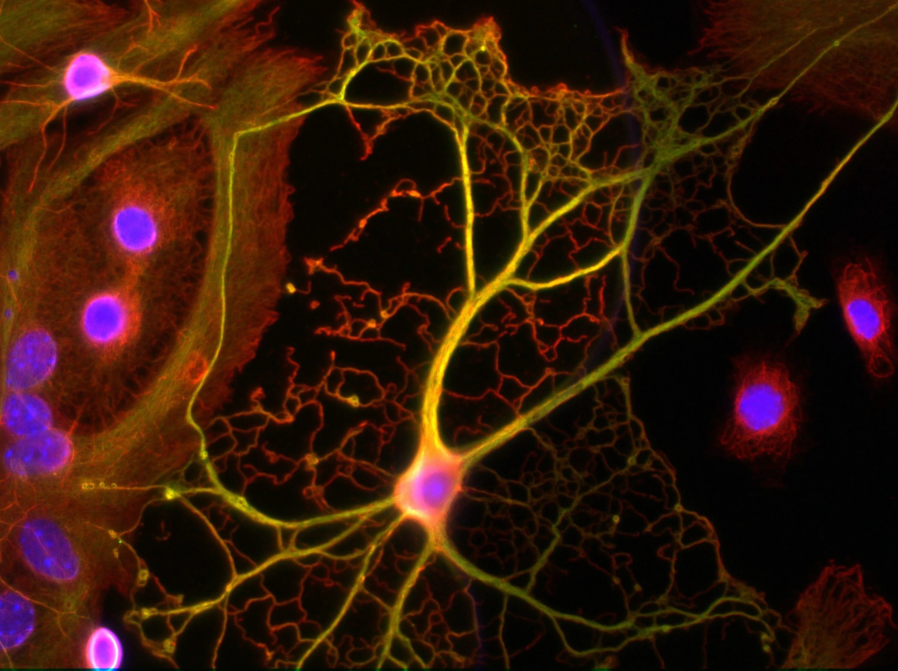 Астроциты мозга. Астроциты клетки. Астроциты микроскоп. Конфокальная микроскопия нейронов. Конфокальная микроскопия мозга.