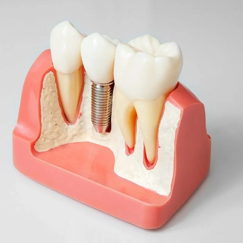 центр имплантации и протезирования спб