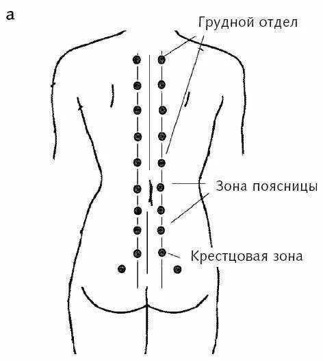 Поставить на поясницу. Схема постановки пиявок на позвоночник. Грудной отдел позвоночника паровертебральнвн точки. Гирудотерапия точки постановки пиявок схемы при остеохондрозе. Массаж спины схема точки.