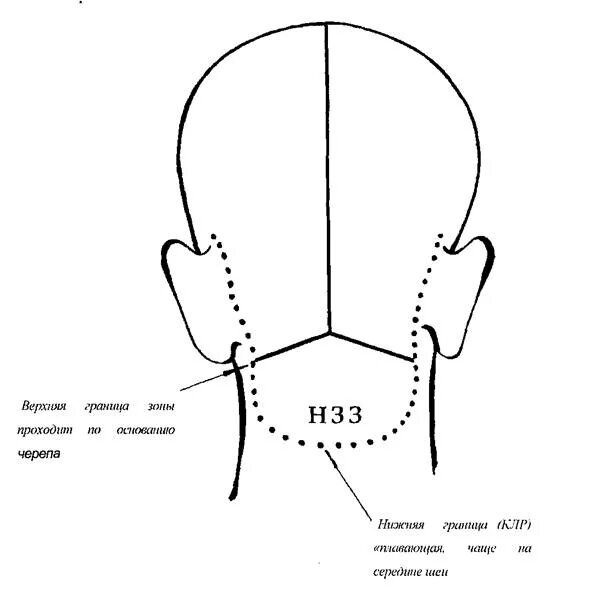 Зона затылка. Нижняя затылочная зона головы схема. Деление на зоны головы НЗЗ. Деление головы на зоны для афрокосичек схемы. Височная зона головы схема.