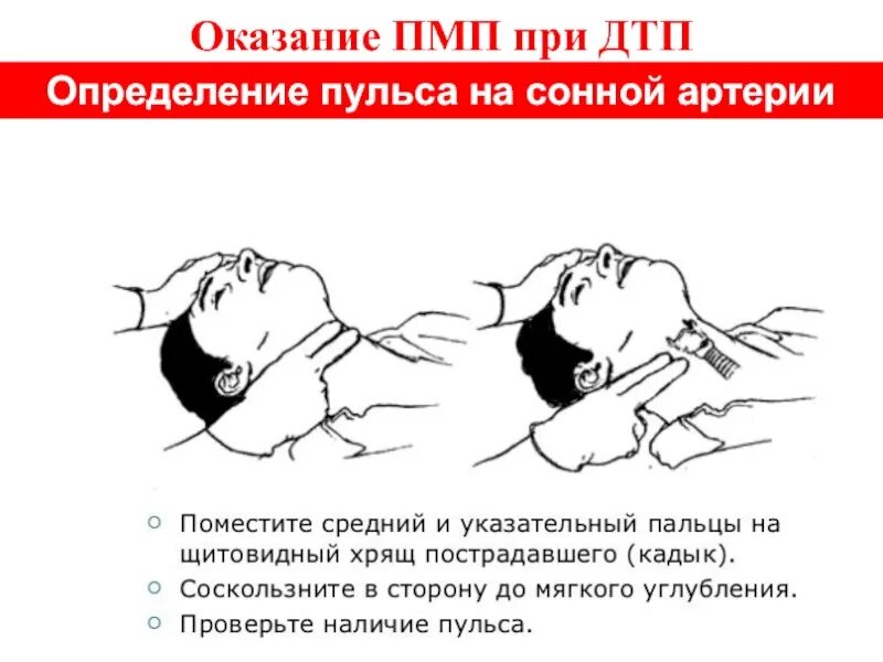 Определение пульса на сонной артерии время. Оказание первой медицинской помощи при дтп. как определить пульс на сонной артерии. последовательность оказания помощи при дтп.. оказание первой медицинской помощи при дтп кратко.