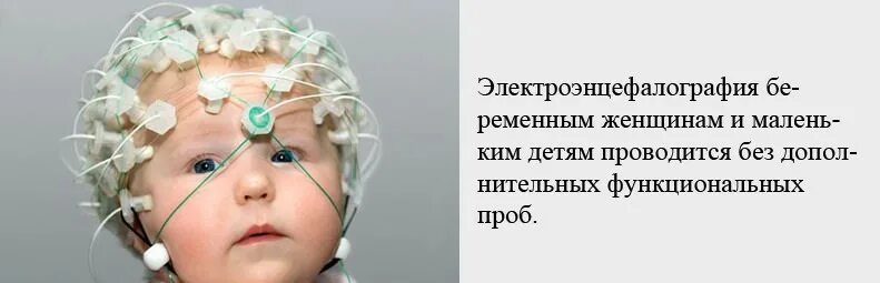 Ээг головного мозга ребенку что это такое. Электроэнцефалограмма головного мозга для детей. энцефалограмма головы ребенку. как делают энцефалограмму головного мозга детям. энцефалограмма головы ребенку как делают.