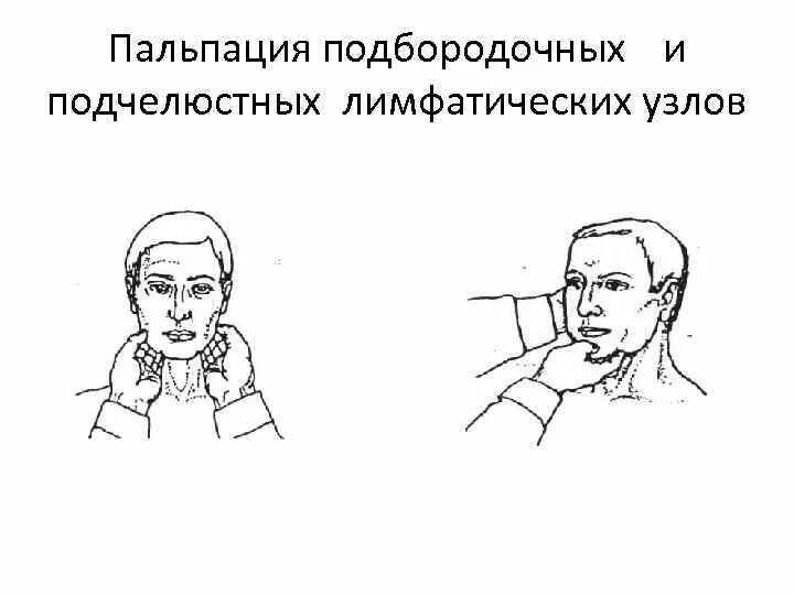 Пальпацияподбородочных лимфатических узлов. Пальпация переднешейных лимфатических узлов. Пальпация периферических лимфатических узлов алгоритм. Пальпация лимфатических узлов пропедевтика внутренних болезней. Подчелюстной лимфоузел размеры норма