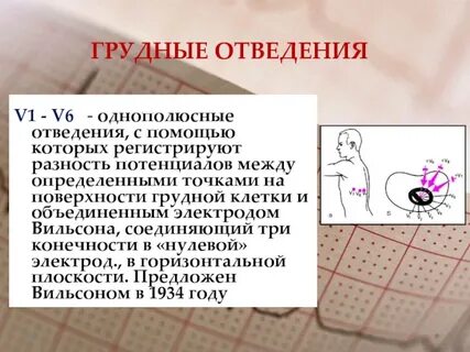 Правые отведения