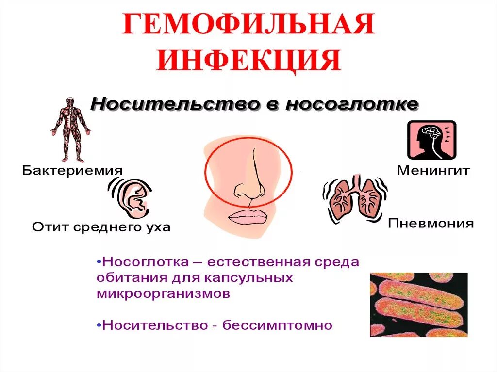 Какие инфекции вызывают. Гемофилы инфлюэнцы патогенез. Гемофильная палочка патогенез. Симптомы гемофильной палочки. Гемофильная палочка симптомы.