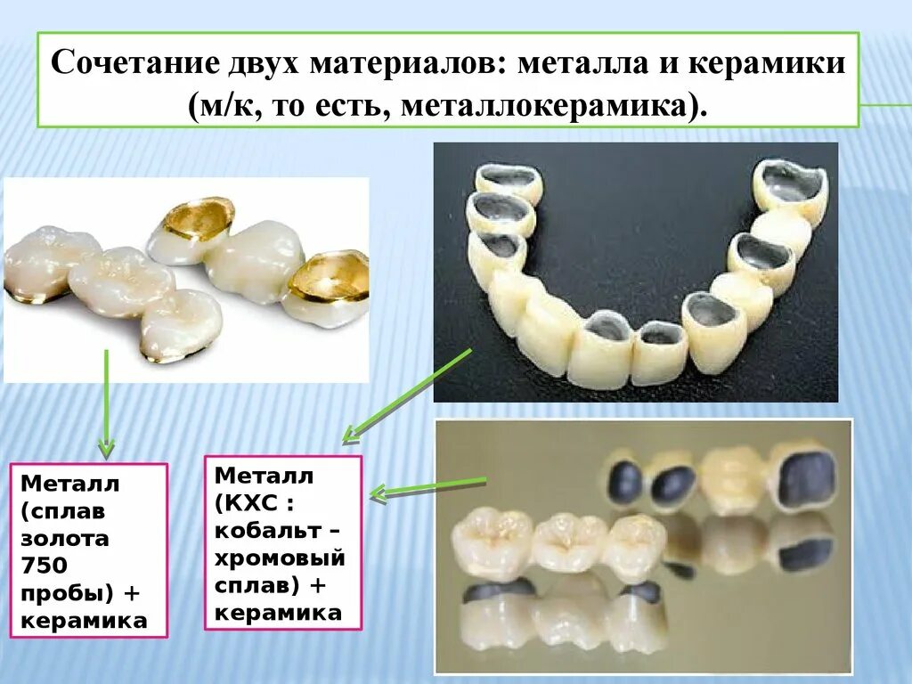 Сцепление металлокерамика. Full диоксид цирконийкерамика. диоксид церконий или керамика. металлокерамика, керамика, диоксид циркония. керамические материалы в стоматологии.