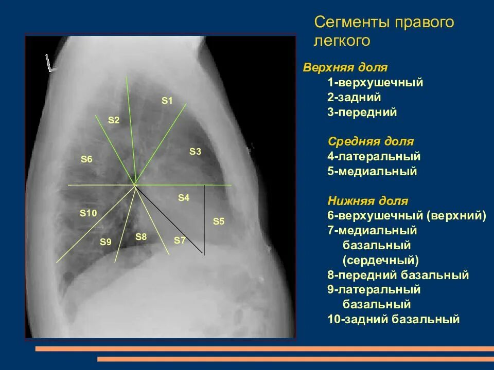 S 1 легкого. Сегменты s1 s2 легких. 4 Сегмент легкого. 6 Сегмент левого легкого. Сегмент s3 левого легкого.