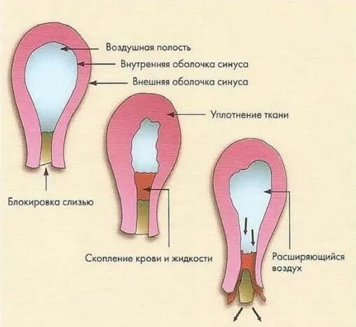 Что означает кровь во рту. Привкус крови во рту причины. Вкус крови во рту причины.