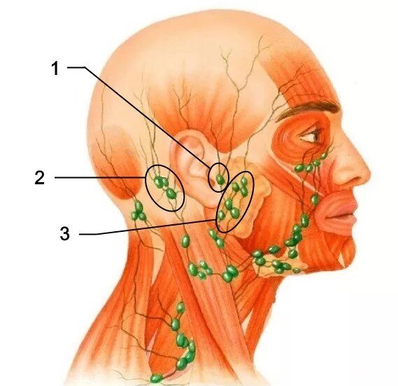 Лимфоузел в мышце. Воспаленные околоушные лимфоузлы. Поднижнечелюстные лимфоузлы. Лимфоузлы подчелюстные расположение. Тонзиллярные лимфоузлы.