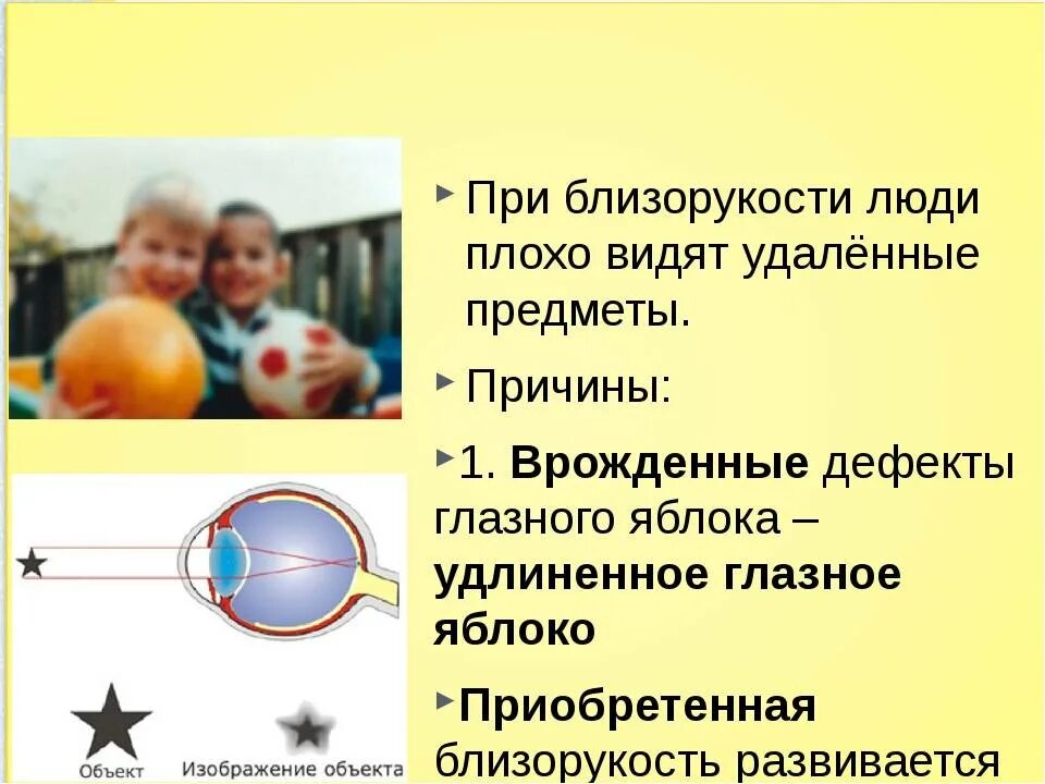 Почему людей пожилого возраста развивается возрастная дальнозоркость. Врожденная и приобретенная близорукость. приобретенная миопия. дальнозоркость врожденная и приобретенная. миопия врожденная и приобретенная.