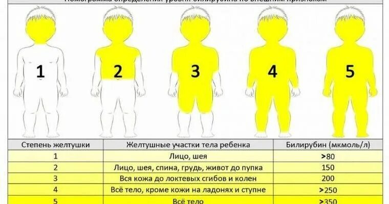 Норма кожи у детей. Показатели нормы по желтушка у новорожденных. симптомы желтушки у ребенка. цвет кожи при желтухе у новорожденных. степени желтухи.