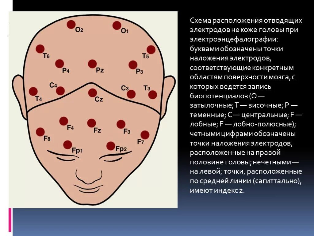 Система ээг. Схема 10-20 наложение электродов. Схема электродов при ЭЭГ. Точки наложения электродов при ЭЭГ. Техника наложения ЭЭГ электродов.