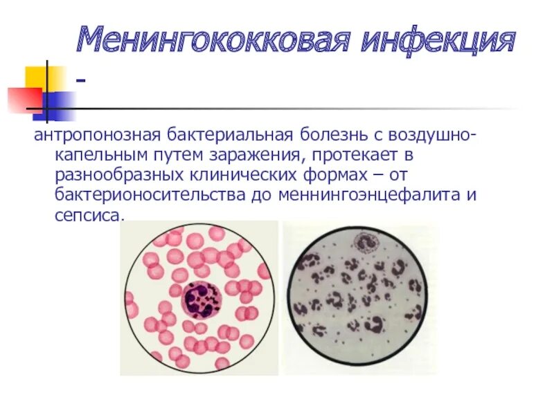 Для менингококковой инфекции характерны. Менингококковая инфекция пути заражения. Менингококковая инфекция лекция. Менингококк микроскопия.