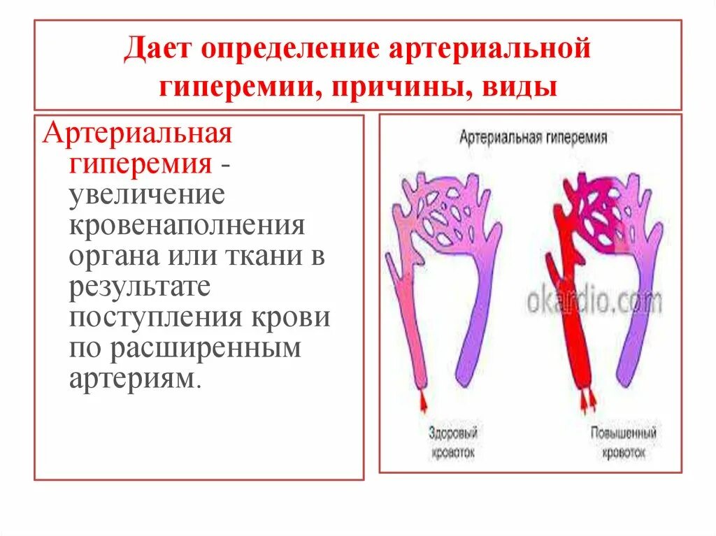 Артериальная венозная гиперемия ишемия таблица. Артериальная гиперемия. Нарушение кровообращения артериальная гиперемия. Виды артериальной гиперемии.