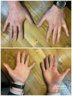 Роле роле на руках