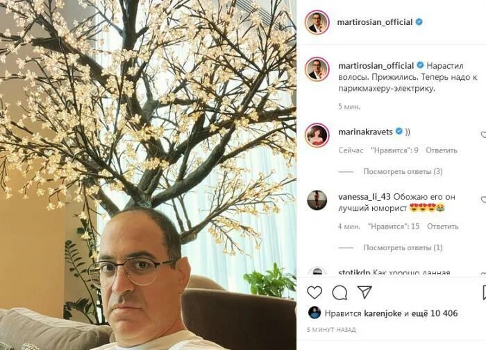Гарик мартиросян пересадил волосы фото После пересадки волос Гарик Мартиросян похорошел! Как вам  ШОУБИЗНЕС ЗВЁЗДЫ И Х