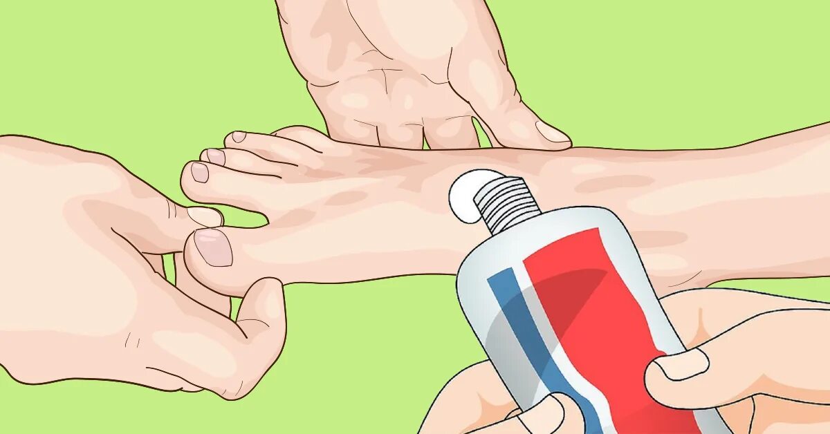 домовые нож намазывают на пятке себе сметану. пятки зубной пастой. пятки зубной пастой. глицерин для пяток с зубной пастой. зубная паста для пяток.