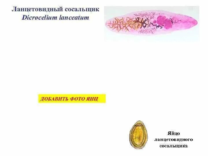 Сосальщики на латинском. Марита ланцетовидного сосальщика. Китайский сосальщик строение. Марита сибирского сосальщика. Черви-сосальщики – трематоды.