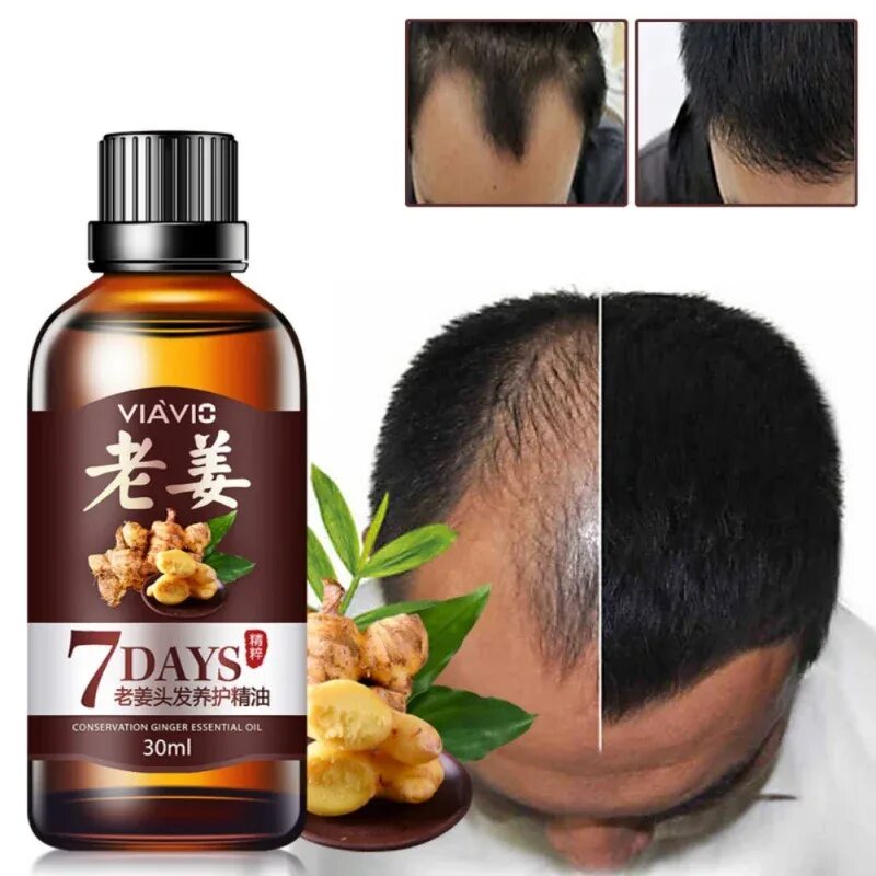 Hair growth Essence Oil. Масло для волос. Мало волос. Масло для волос китайское.