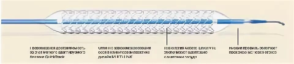 Система стента