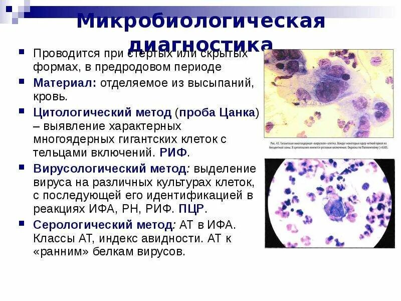 Цитологический метод примеры. Тельца гварниери микробиология. цитология клетки тцанка. тельца гварниери цитология. цитологические методы исследования в микробиологии.