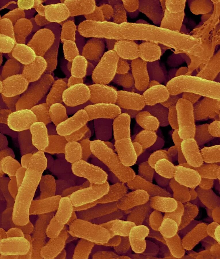 Bacteroides spp что это. Bacteroides fragilis возбудитель. бактероиды фрагилис bacteroides fragilis. bacteroides melaninogenicus. bacteroides fragilis микробиология.