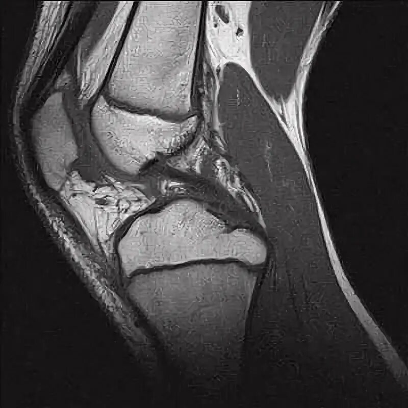 Мрт коленного сустава омс. Мрт коленного сустава 1.5 Тесла. Т1 и т2 мрт коленного сустава. Мрт коленного сустава в СПБ. Сосуды коленного сустава мрт.