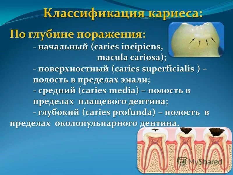 Классификация поражений зубов