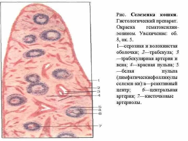 Селезенка препарат гистология. Строение селезенки гистология. селезенка гистологический препарат. селезенка окраска гематоксилин-эозином. селезенка препарат гистология с обозначениями.