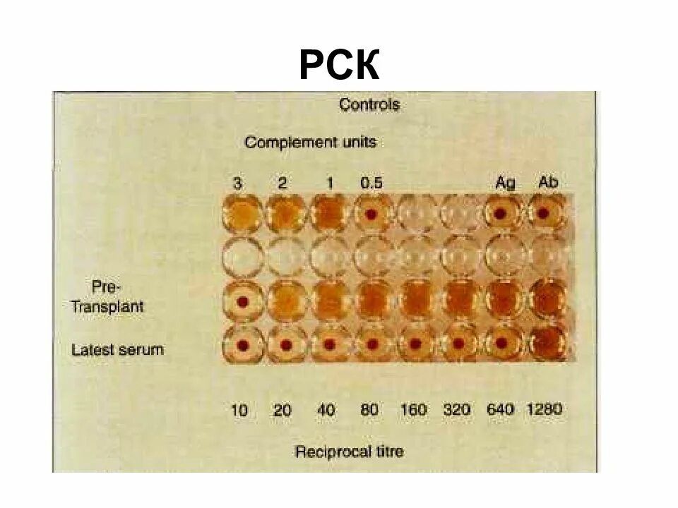 Комплемента рск. Реакция связывания комплемента РСК. Схема постановки РСК. Реакция РСК микробиология. Серологические реакции РСК.