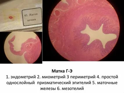 Периметрий