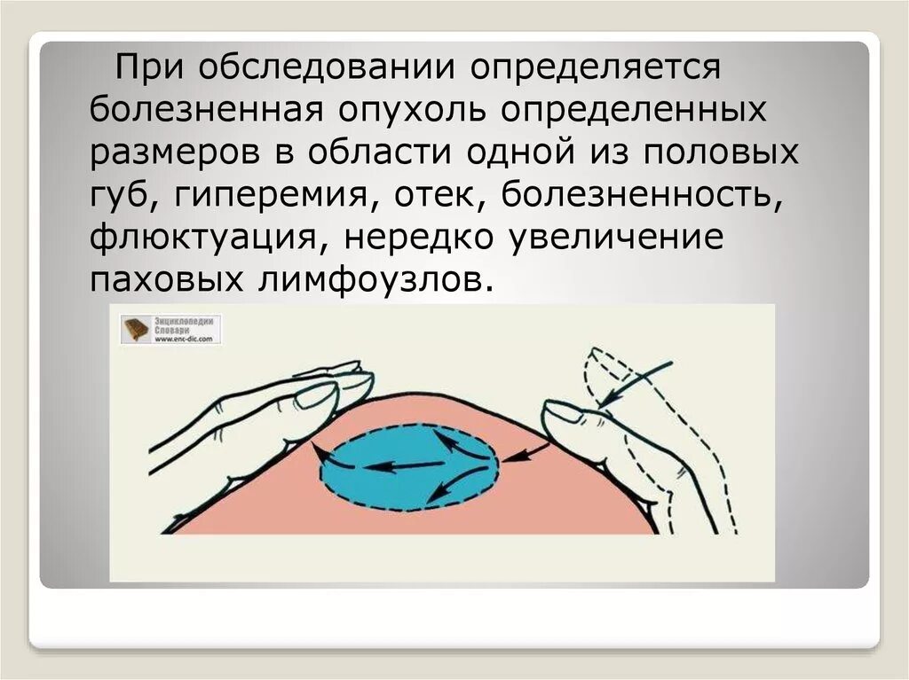 Флюктуация инфильтрата. Флюктуация инфильтрата. Флюктуация инфильтрата. Симптом флюктуации встречается при. Флюктуация инфильтрата.