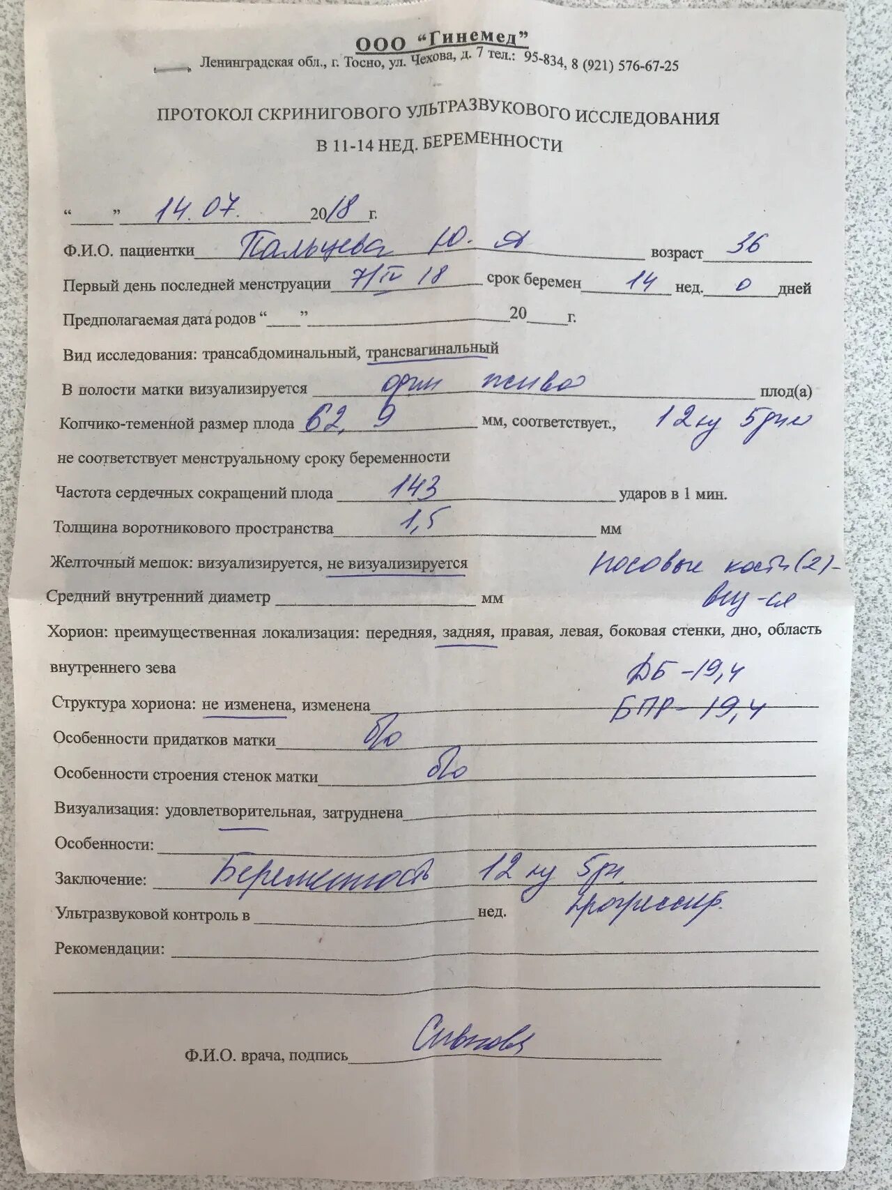 Результаты биопсии хориона
