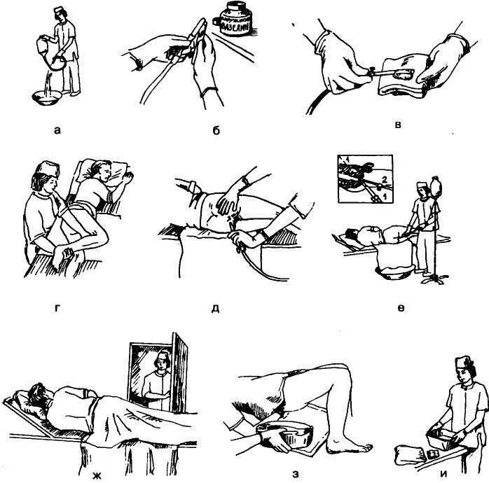 Очистительная клизма алгоритм. Техника постановки гипертонической клизмы алгоритм. Постановка гипертонической клизмы алгоритм. Постановка очистительной клизмы алгоритм.