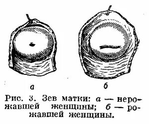 Маточный зев. Наружный зев шейки матки. Внутренний и наружный зев шейки матки. Наружный маточный зев шейки матки. Наружный зев шейки матки у рожавших.