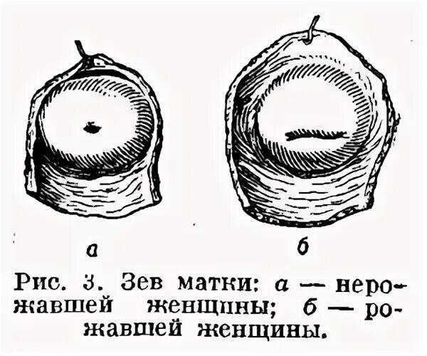 Зев канала шейки матки