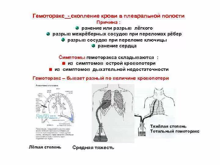 Скопление крови в плевральной полости